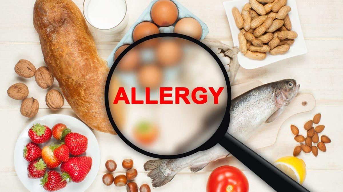 Food Allergy and Intolerance
